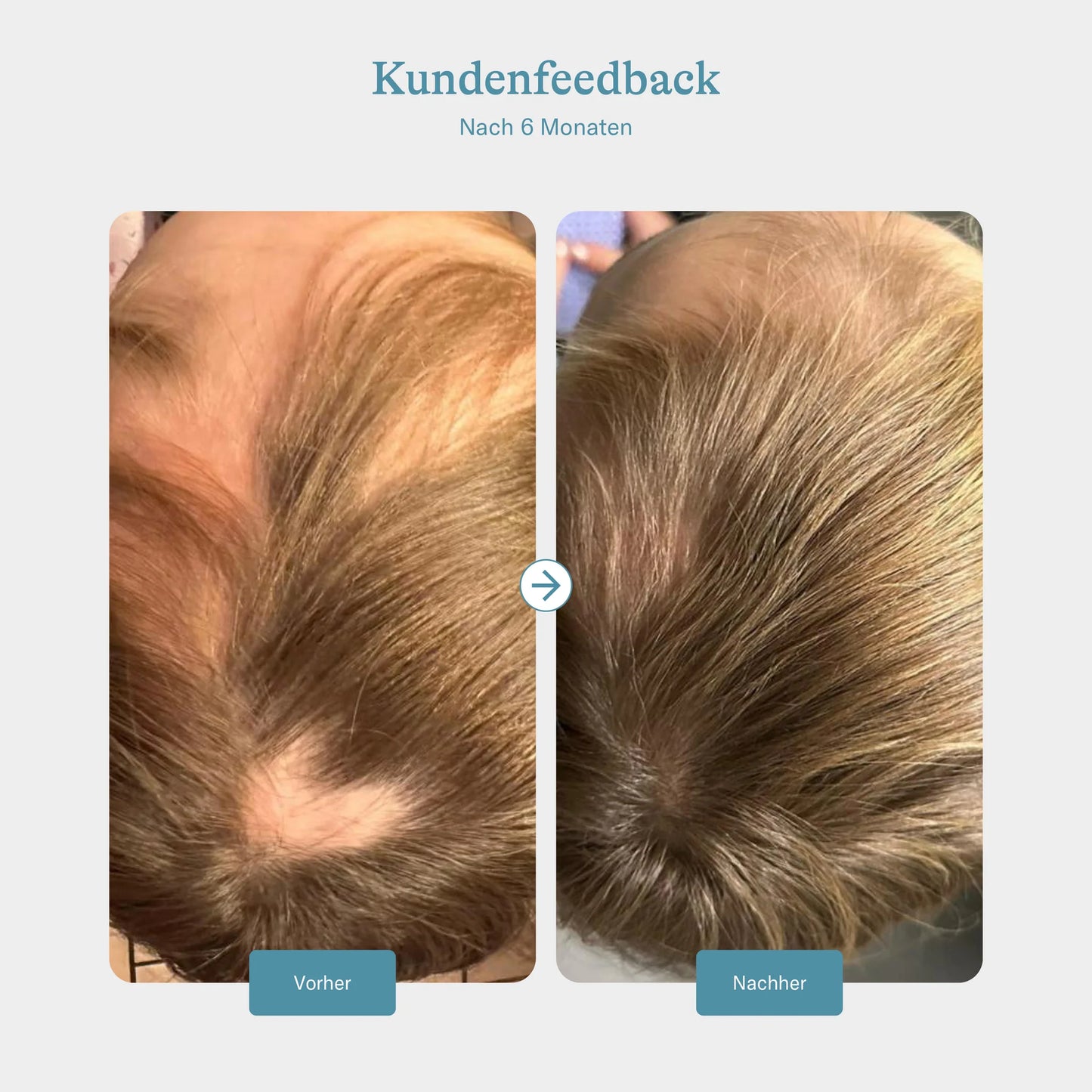KERATIN HAIR BOOSTER WOMEN 18-45 - 60 Kapseln