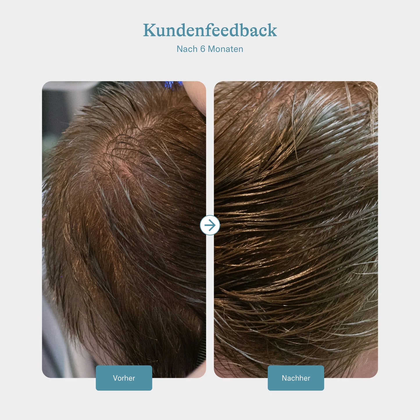 KERATIN HAIR BOOSTER MEN - 90 Kapseln á 451 mg